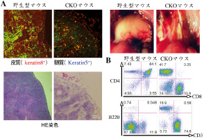 成体胸腺ニッチの維持・再生の転写因子による制御 上皮細胞における転写因子欠損による 胸腺の消失（A）とリンパ節様転換（B）